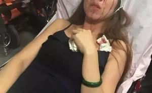 女模特坐滴滴快車(chē)遇車(chē)禍致毀容，客服承認(rèn)司機(jī)“人車(chē)不符”