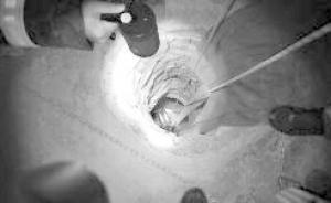 兒媳因家庭矛盾跳井，75歲公公下井將她救起后自己卻被困