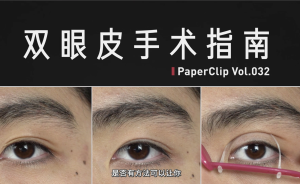 點開需謹慎 | 雙眼皮手術指南 