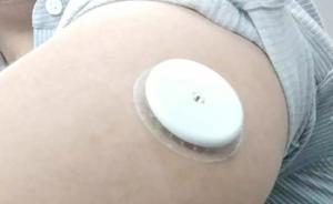 YY創(chuàng)始人往體內植入了塊假芯片？只是收集血糖數(shù)據(jù)的傳感器