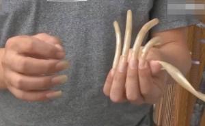 男子留8年长指甲戒赌明志，定期护理