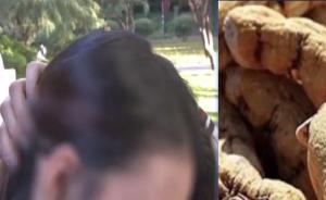 母親聽信“治脫發(fā)偏方”，致女兒肝損傷?