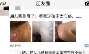 ?遼寧一小學(xué)生往同學(xué)身上澆熱水致其受傷，副校長被免職調(diào)離