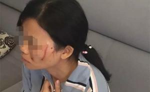 因車位糾紛，南寧一對母子將鄰居打成腦震蕩：登門道歉賠3萬