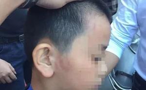 福建：12歲學(xué)生被托管班老板打成腦震蕩，警方已受案