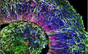 實驗室培育“迷你大腦”發出類似人類腦電波，有助于研究癲癇