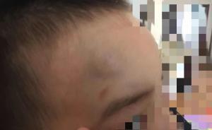 长春南关区教育局通报幼儿园老师踢伤男童头部，涉事老师被拘