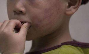 马上评｜“反削”老师者被抓后，拿什么来回应激动的网友？