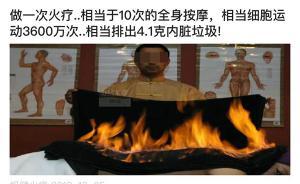 權(quán)健火療有多神奇？中醫(yī)專家：我不知道這和毛巾熱敷有何區(qū)別