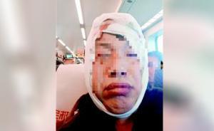动车上男乘客被掉落行李箱砸掉一小块头皮，拟向铁路部门索赔
