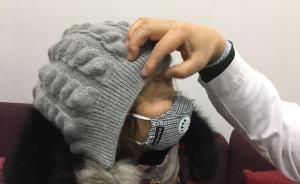 成都女子連吃幾天火鍋頭腫變形，竟因20年前打了奧美定