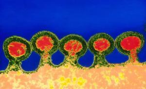 HIV宿主中發(fā)現(xiàn)新的抗病毒機(jī)制，有望成為新抗病毒藥物靶點(diǎn)