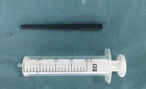 嚇傻了！2歲女童玩耍時(shí)下巴被筷子插入近十厘米，幸好已取出