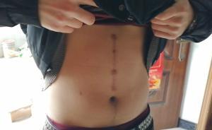 母親放棄重病兒，父親割肝救子