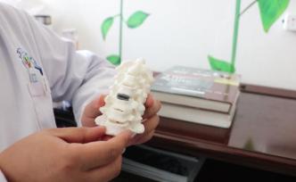 全球首例！3D打印頸椎間盤置換術(shù)完成