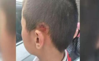 太原一民辦校11歲男生遭男老師暴力推甩，脖頸處和耳朵受傷