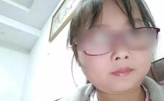 杭州失聯(lián)女童姑父：尚未收到尸檢結(jié)果，家屬暫沒考慮民事賠償