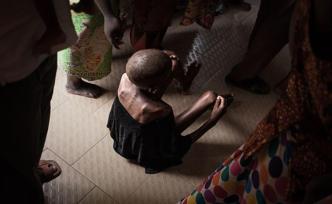 聯(lián)合國報告顯示2018年全球8.2億人挨餓