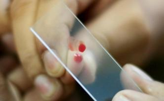 滴血當(dāng)真能驗(yàn)癌，還只是“看上去很美”？