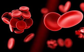 身體有血栓，這六個(gè)部位會(huì)“說話”