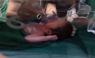 龐貝病媽媽力拒爭(zhēng)議生子：我有生育權(quán)