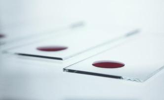 為推銷山藥粉在店內(nèi)擅自采血、虛構(gòu)檢測結(jié)果：浙江一商戶被罰