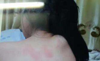 女教師因毆打女童致其精神殘疾獲刑，案件發(fā)回重審法院受理