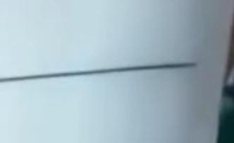 伊春11岁体校女孩心脏部位取出7厘米钢针，受伤原因待查