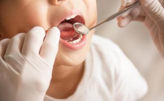 上海成年人齲齒患病率超90%，每天刷牙兩次及以上僅60%