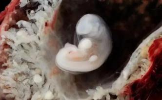 媽媽的子宮是所“整容院”：你比自己最丑的時候好看多了