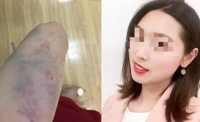 女教师坠亡被指遭家暴,警方:自杀不立案