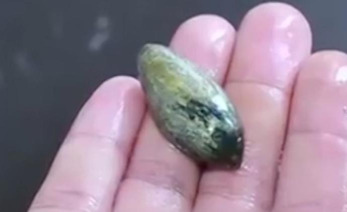 老人聽信偏方生吃魚膽進(jìn)ICU，肝腎衰竭