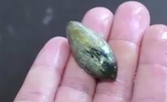 老人听信偏方生吃鱼胆进ICU，肝肾衰竭