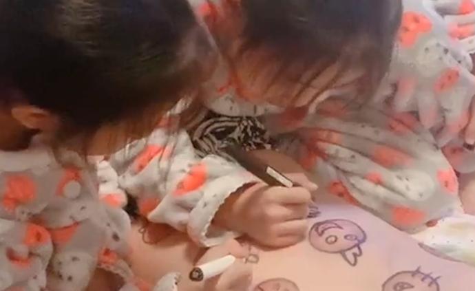 爹拔罐留印，雙胞胎女兒畫出“動物園”