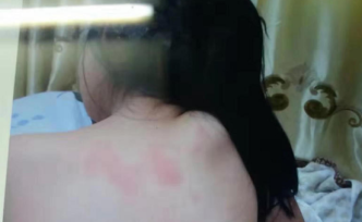 8歲女童被老師毆打致精神殘疾案重審，涉案女教師仍在任教