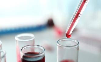 1滴血測(cè)13種癌癥？日本東芝新技術(shù)2020年將實(shí)證試驗(yàn)