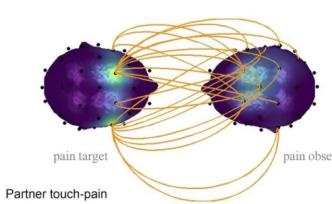 首次證明：牽手就能同步腦電波，還能緩解疼痛