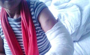 河南光山退休教師到縣政府反映問題，被保安打斷手肘