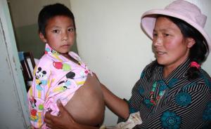 有蟲癌患者無錢看病因不了解政策，四川副省長：防治規(guī)劃報(bào)批