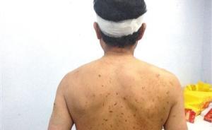 阜新28死礦難背后：全國首個資源枯竭城市13年轉型未了局