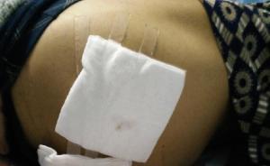 福州一民警配枪走火致男子臀部受伤：交通执法时遭拒发生推搡