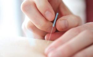 “針刺放血”真能排毒瘦身嗎？專家稱自行操作或傷及性命