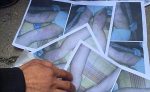 河南6齡童遭暴力體罰“不能平躺”，官方：當(dāng)事老師是臨時(shí)工