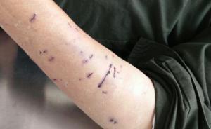 山东临沂一村民被曝“遭拆迁人员打死”，官方：与拆迁无关