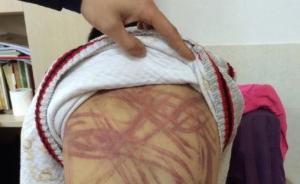 南京虐童案親生父母起訴“虐童事件”發(fā)帖人侵權(quán)，被法院駁回