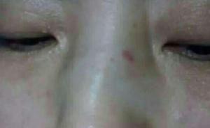 上海名校女教師打斷值班女醫(yī)生鼻梁，被曝曾參選語文教學(xué)之星