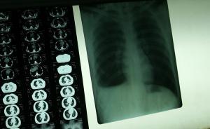 江苏常州一企业曝多人感染肺结核疫情，官方：已确诊14例