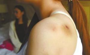 兩女孩入住成都一四星級酒店遭醉酒男暴打：保安沒攔住