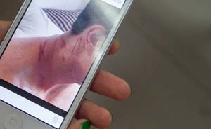 怪120来得慢，近10名“酒汉”持铁棍砖头群殴3名急救人员