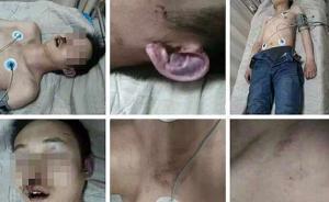 山西一少年被指網(wǎng)吧內(nèi)遭6人虐打4小時身亡，無人阻攔報警